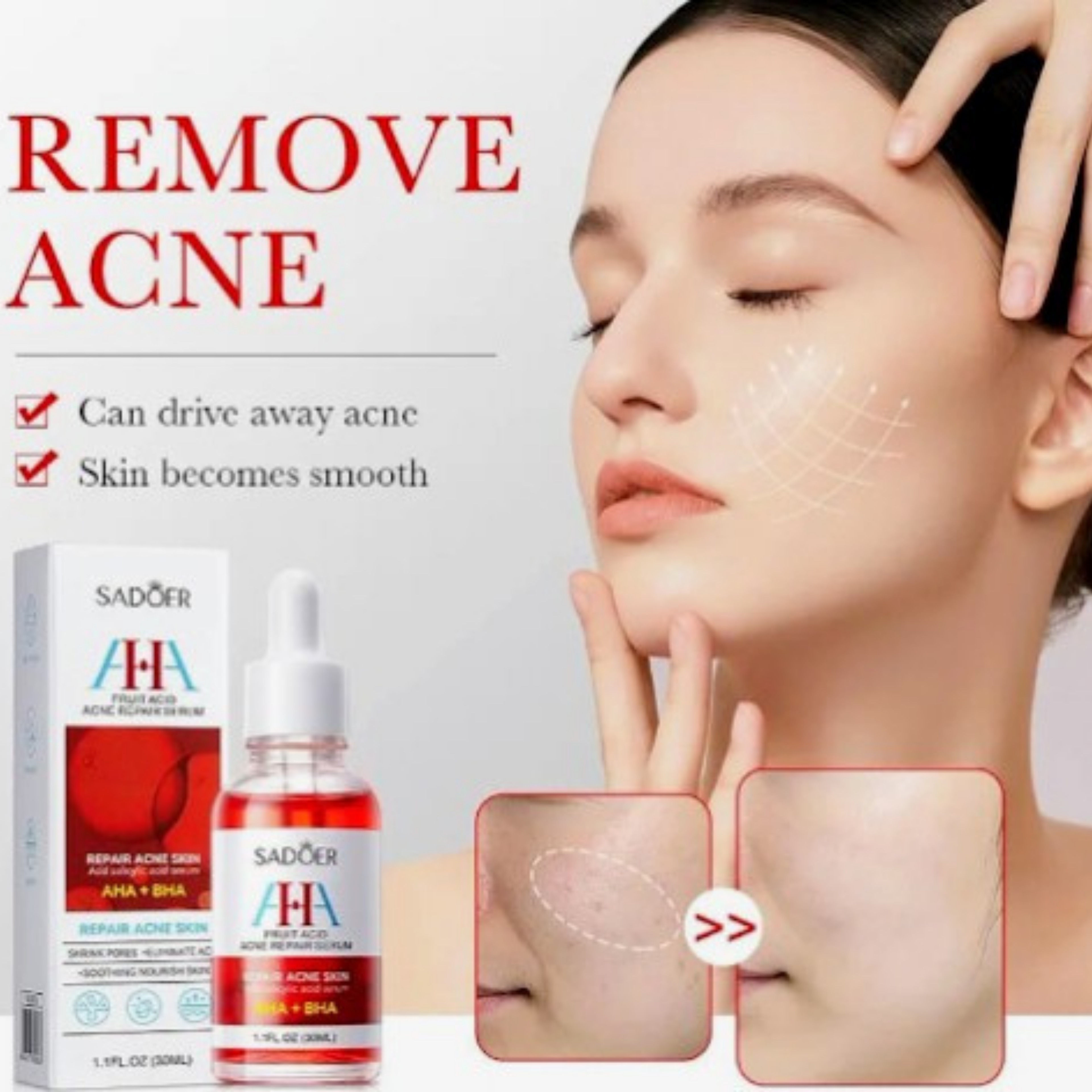 Serum reparador de acne y cicatrices