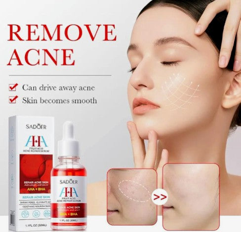 Serum reparador de acne y cicatrices