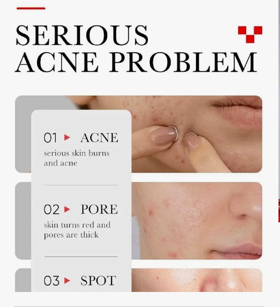 Serum reparador de acne y cicatrices