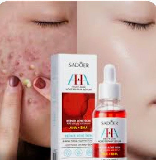 Serum reparador de acne y cicatrices