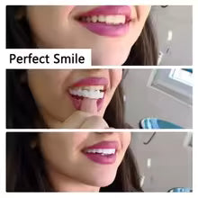 Carillas- 😁FlexiSmile